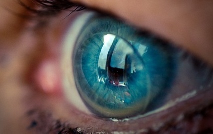 <span style="font-weight: normal;">контактные линзы </span>